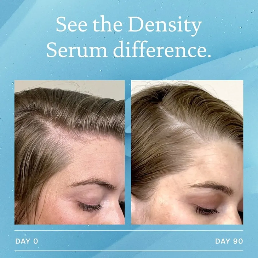 Living Proof Scalp Care Density Serum von