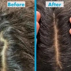 Umberto Giannini Scalp Restore Scalp Reviving Anti-Dandruff Shampoo von