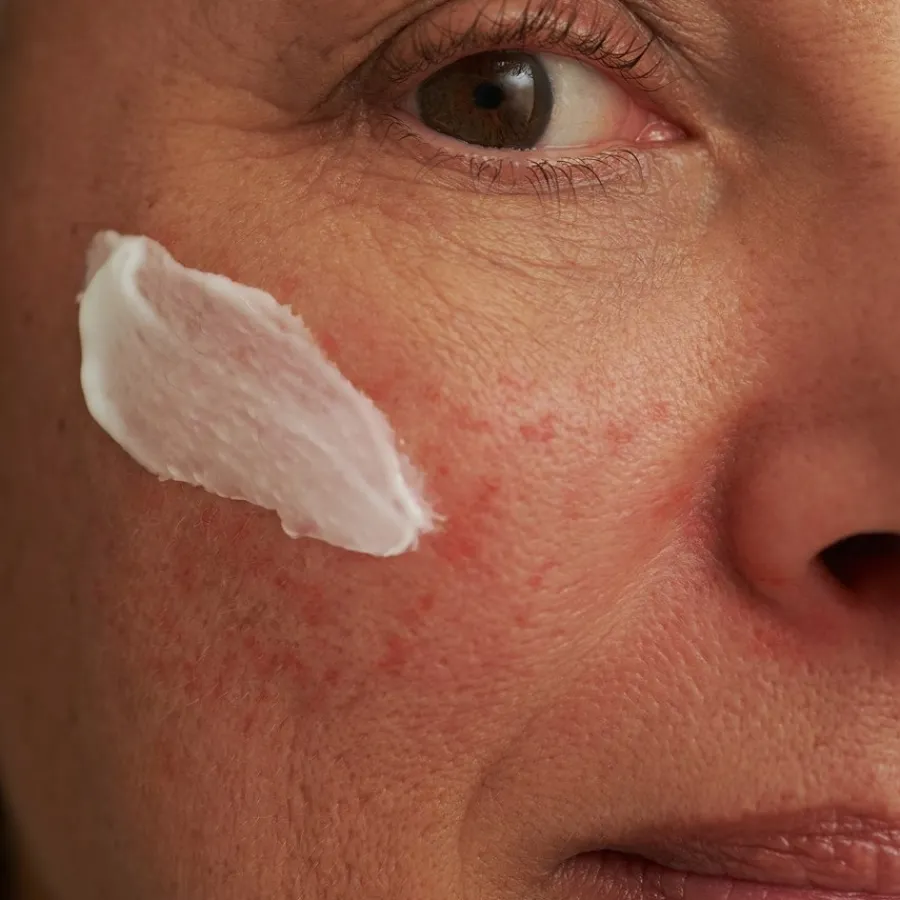 DADO SENS SENSACEA GESICHTSMASKE - bei hypersensibler Haut & Couperose von