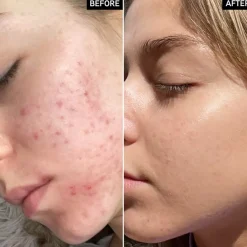 The INKEY List Seren Niacinamide Serum von