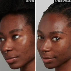 The INKEY List Seren Tranexamic Acid Serum von