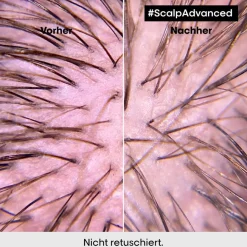 Lu2019Oru00E9al Professionnel Paris Serie Expert Scalp Advanced Anti-Discomfort Intense Soother Treatment von L’Oréal Professionnel Paris