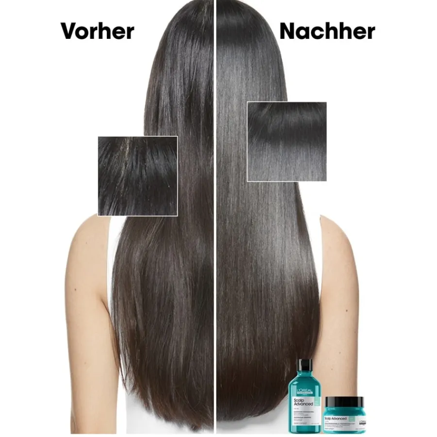 Lu2019Oru00E9al Professionnel Paris Serie Expert Scalp Advanced Anti-Oiliness Dermo-purifier Shampoo von L’Oréal Professionnel Paris