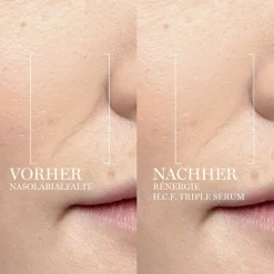 Lancu00F4me Serum Rénergie H.C.F. Triple Serum von Lancôme Sale