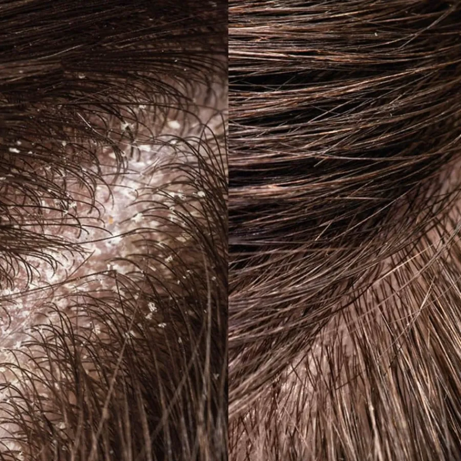 Rosental Organics Shampoo Exfoliating Hair Brush von Clearance