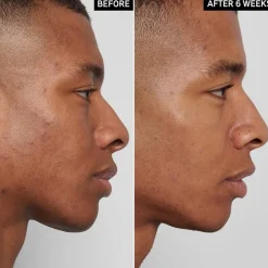 The INKEY List Mandelic Acid Treatment