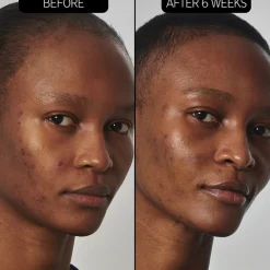 The INKEY List SuperSolutions 20% Niacinamide Serum