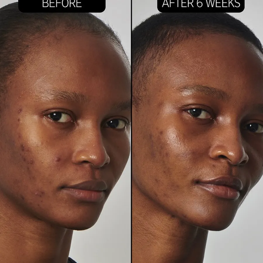 The INKEY List SuperSolutions 20% Niacinamide Serum